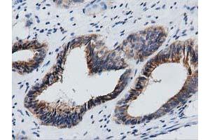 Immunohistochemical staining of paraffin-embedded Human Kidney tissue using anti-GAS7 mouse monoclonal antibody. (GAS7 anticorps)
