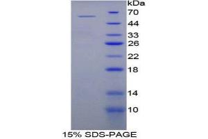 SDS-PAGE (SDS) image for beta-Site APP-Cleaving Enzyme 2 (BACE2) (AA 156-407) protein (His tag,GST tag) (ABIN1879503)