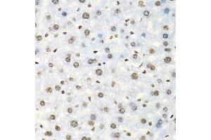 Immunohistochemistry of paraffin-embedded mouse liver using IGF2BP2 antibody (ABIN5971464) at dilution of 1/100 (40x lens). (IGF2BP2 anticorps)