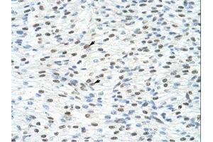 Image no. 1 for anti-Matrin 3 (MATR3) (N-Term) antibody (ABIN203258)