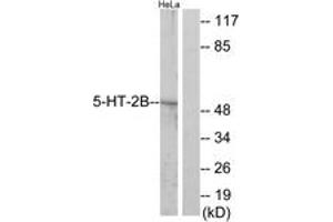 Western blot analysis of extracts from HeLa cells, using 5-HT-2B Antibody. (Serotonin Receptor 2B anticorps  (AA 261-310))