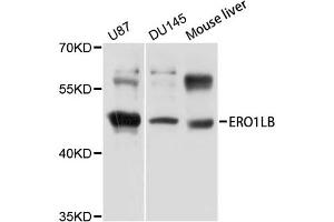 Western blot analysis of extracts of various cell lines, using ERO1LB antibody (ABIN5971901) at 1/1000 dilution. (ERO1LB anticorps)