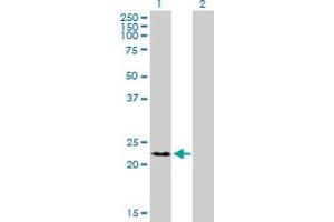 Western Blot analysis of RNF166 expression in transfected 293T cell line by RNF166 MaxPab polyclonal antibody. (RNF166 anticorps  (AA 1-237))