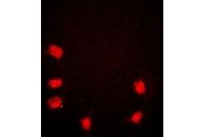 Immunofluorescent analysis of Rpb1 CTD staining in HeLa cells. (Rpb1 CTD anticorps  (C-Term))