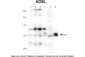 Sample Type: 1. (Adenylosuccinate Lyase anticorps  (Middle Region))