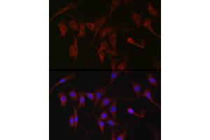 Immunofluorescence analysis of NIH/3T3 cells using PKC zeta Rabbit pAb (ABIN6128468, ABIN6146211, ABIN6146213 and ABIN6221376) at dilution of 1:100 (40x lens).