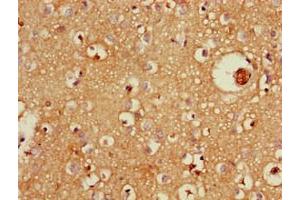 Immunohistochemistry of paraffin-embedded human brain tissue using ABIN7176064 at dilution of 1:100 (ZFYVE26 anticorps  (AA 2306-2473))