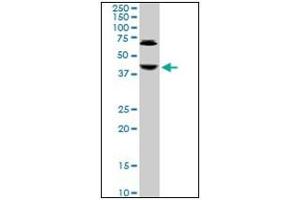 Western Blotting (WB) image for anti-Abhydrolase Domain Containing 5 (ABHD5) antibody (ABIN781986)