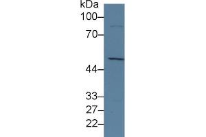 Detection of KDM4A in Human Hela cell lysate using Polyclonal Antibody to Lysine Specific Demethylase 4A (KDM4A) (KDM4A anticorps  (AA 141-310))