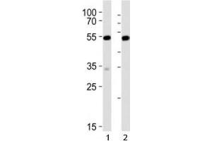 Western blot analysis of lysate from 1) mouse NIH3T3 and 2) rat C6 cell line using Srf antibody at 1:1000. (SRF anticorps  (C-Term))