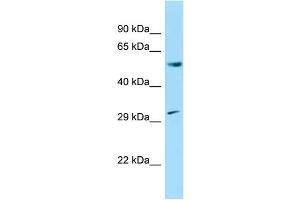WB Suggested Anti-Ccnl1 Antibody Titration: 1. (Cyclin L1 anticorps  (N-Term))