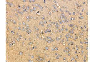 ABIN6255025 and ABIN6266462 at 1/100 staining Rat brain tissue by IHC-P. (RIPK2 anticorps  (pSer176))