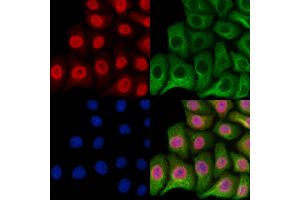 ABIN6257252 and ABIN6273611 staining Hela cells by IF/ICC. (HSPB8 anticorps  (C-Term))