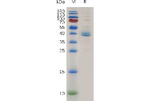 Human TG Protein, hFc Tag on SDS-PAGE under reducing condition.