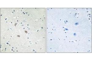 Immunohistochemistry analysis of paraffin-embedded human brain tissue, using Akt2 (Ab-474) Antibody. (AKT2 anticorps  (AA 432-481))