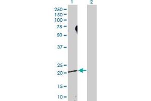Western Blot analysis of SDCBP expression in transfected 293T cell line by SDCBP MaxPab polyclonal antibody.