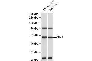 Western blot analysis of extracts of various cell lines, using CLN3 antibody (ABIN3015724, ABIN3015725, ABIN1679284 and ABIN6219075) at 1:1000 dilution. (CLN3 anticorps  (AA 1-280))