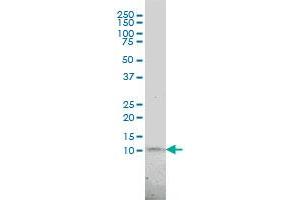 KIAA0101 monoclonal antibody (M01), clone 3C11-1F11 Western Blot analysis of KIAA0101 expression in JAR