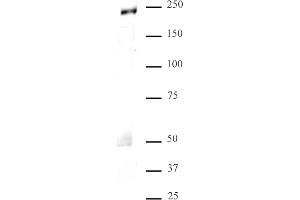MED1 antibody (pAb) tested by Western blot. (MED1 anticorps  (C-Term))