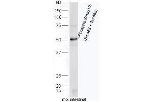 Mouse intestine lysates probed with Rabbit Anti-Smad1/5 (Ser463+Ser465) Polyclonal Antibody, Unconjugated (ABIN746033) at 1:300 overnight at 4˚C. (Smad1/5 anticorps  (pSer463, pSer465))