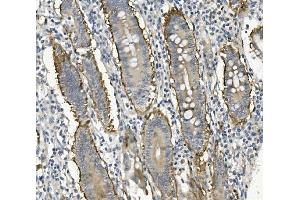 IHC analysis of Integrin beta 4/ITGB4 using anti-Integrin beta 4/ITGB4 antibody (ABIN7601135). (Integrin beta 4 anticorps  (AA 29-431))