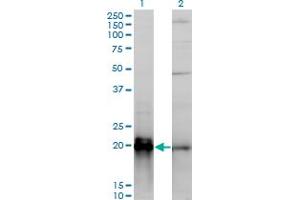 Western Blot analysis of KRAS expression in transfected 293T cell line by KRAS monoclonal antibody (M01), clone 3B10-2F2. (K-RAS anticorps  (AA 1-188))
