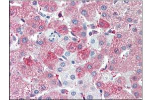 Human Liver (formalin-fixed, paraffin-embedded) stained with SIL1at 5 µg/ml followed by biotinylated anti-goat IgG secondary antibody, alkaline phosphatase-streptavidin and chromogen. (SIL1 anticorps  (C-Term))