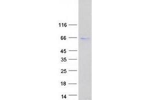 Validation with Western Blot