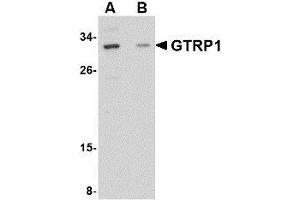Western blot analysis of GRTP1 in SK-N-SH cell lysate with AP30388PU-N GRTP1 antibody at 1 μg/ml in the (A) absence and (B) presence of blocking peptide. (GRTP1 anticorps  (Center))