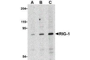 Western Blotting (WB) image for anti-DEAD (Asp-Glu-Ala-Asp) Box Polypeptide 58 (DDX58) antibody (ABIN2476364) (DDX58 anticorps)