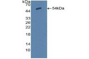 Detection of Recombinant SCNN1a, Human using Polyclonal Antibody to Amiloride Sensitive Sodium Channel Subunit Alpha (SCNN1a)