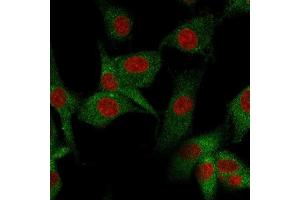 Immunofluorescence staining of U87MG cells using CD73 Mouse Monoclonal Antibody (NT5E/2545) followed by goat anti-Mouse IgG conjugated to CF488 (green).