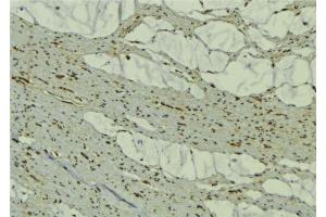 ABIN6277442 at 1/100 staining Mouse muscle tissue by IHC-P. (TRIM63 anticorps  (N-Term))