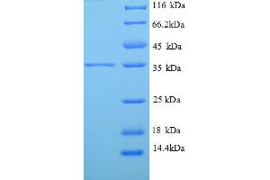 SDS-PAGE (SDS) image for Tropomyosin-2 (TPM2) (AA 14-284), (partial) protein (His tag) (ABIN5712854)