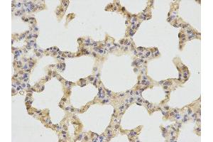 Immunohistochemistry (IHC) image for anti-Cathepsin D (CTSD) antibody (ABIN1872099) (Cathepsin D anticorps)