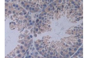 Detection of IL12A in Mouse Testis Tissue using Polyclonal Antibody to Interleukin 12A (IL12A)