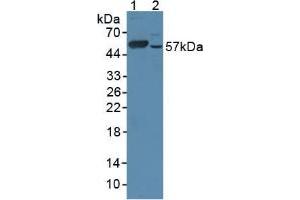 Figure. (CYP17A1 anticorps  (AA 201-507))