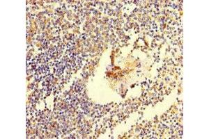 Immunohistochemistry of paraffin-embedded human spleen tissue using ABIN7171802 at dilution of 1:100 (TSBP1 (AA 239-476) anticorps)