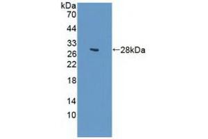 Figure. (GUCY1B3 anticorps  (AA 408-619))