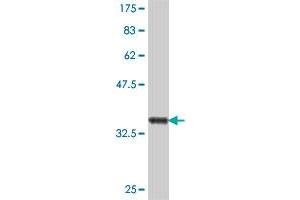 Western Blot detection against Immunogen (37 KDa) .