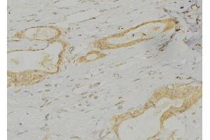 ABIN6277357 at 1/100 staining Human lung tissue by IHC-P. (LAMP3 anticorps  (Internal Region))
