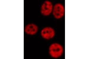 ABIN6267012 staining Hela by IF/ICC. (CTBP1 anticorps  (Internal Region))