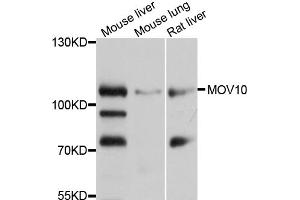 Western blot analysis of extracts of various cell lines, using MOV10 antibody (ABIN5972138) at 1/1000 dilution.