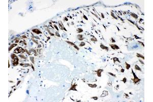 IHC analysis of CPI17 alpha using anti- CPI17 alpha antibody .