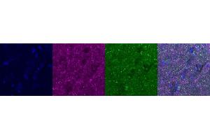 Immunohistochemistry (IHC) image for anti-Cannabinoid Receptor 1 (CNR1) antibody (ABIN7456057)