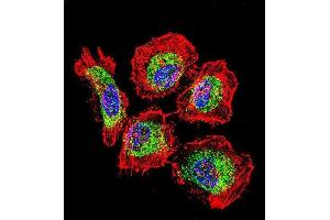 Confocal immunofluorescent analysis of Vimentin Antibody with Hela cell followed by Alexa Fluor 488-conjugated goat anti-rabbit lgG (green).