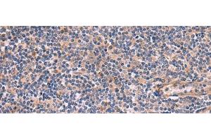 Immunohistochemistry of paraffin-embedded Human tonsil tissue using ARIH2 Polyclonal Antibody at dilution of 1:80(x200) (ARIH2 anticorps)