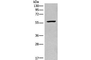 Western blot analysis of Mouse heart tissue lysate using CDADC1 Polyclonal Antibody at dilution of 1:450 (CDADC1 anticorps)