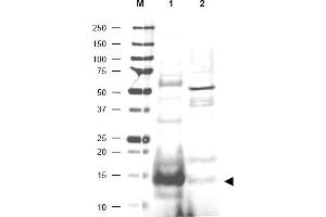 Image no. 1 for anti-Ubiquitin-Conjugating Enzyme E2N (UBE2N) (AA 40-51) antibody (ABIN401175) (UBE2N anticorps  (AA 40-51))
