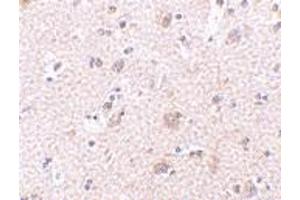 Immunohistochemistry of ARMET in human brain tissue with ARMET polyclonal antibody  at 2. (MANF anticorps  (N-Term))